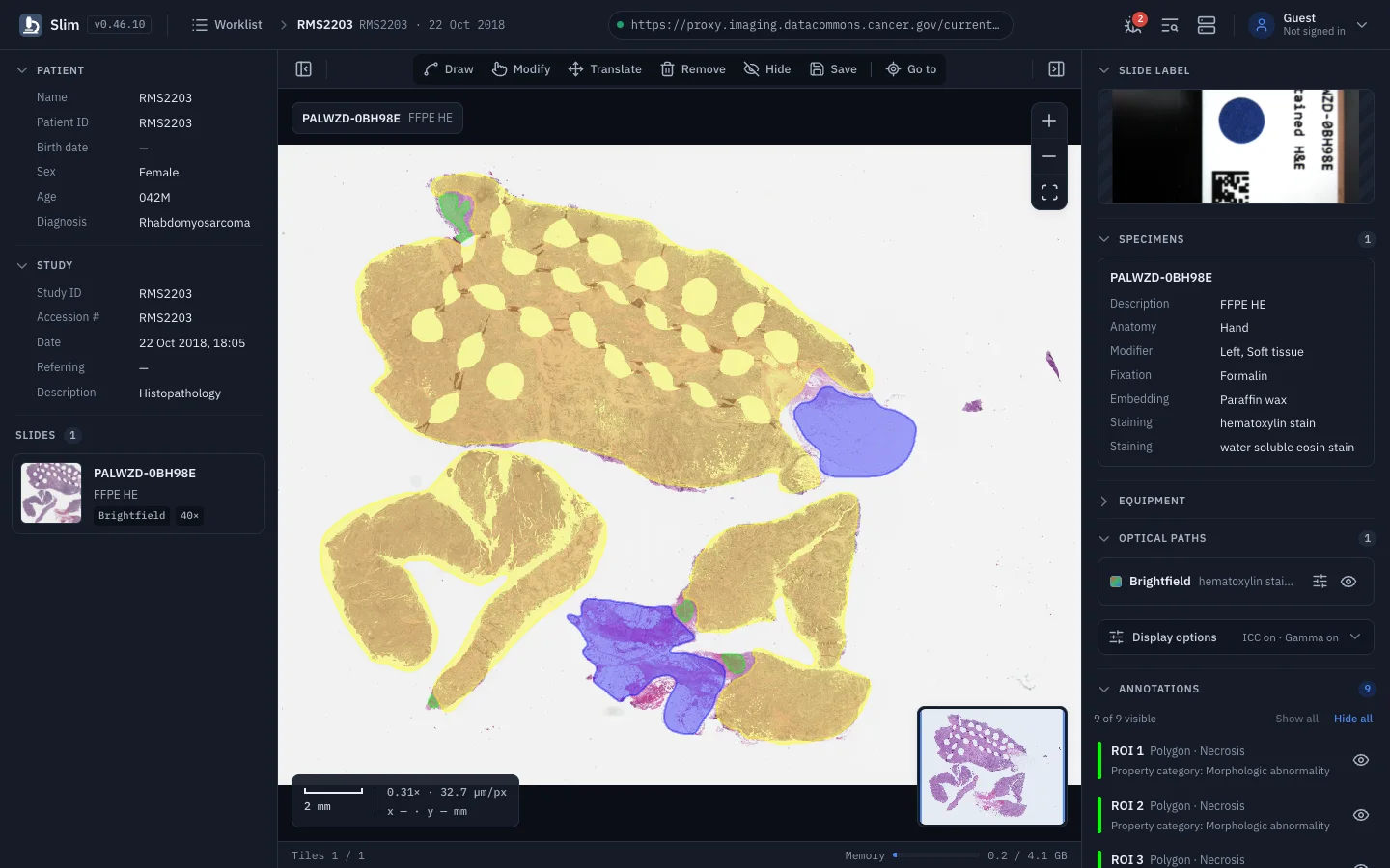 Slim: Draw, measure and save as DICOM