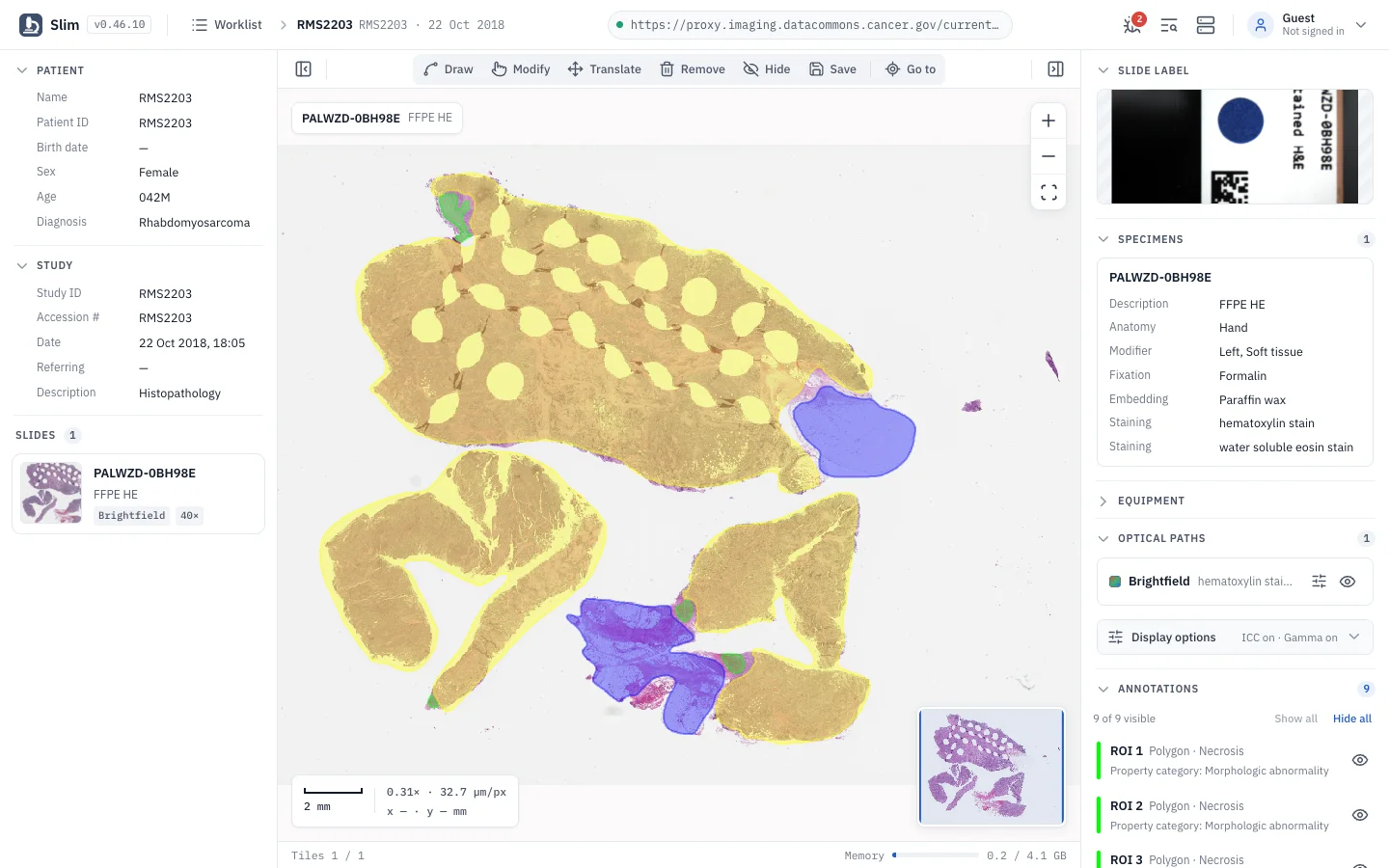 Slim: Draw, measure and save as DICOM