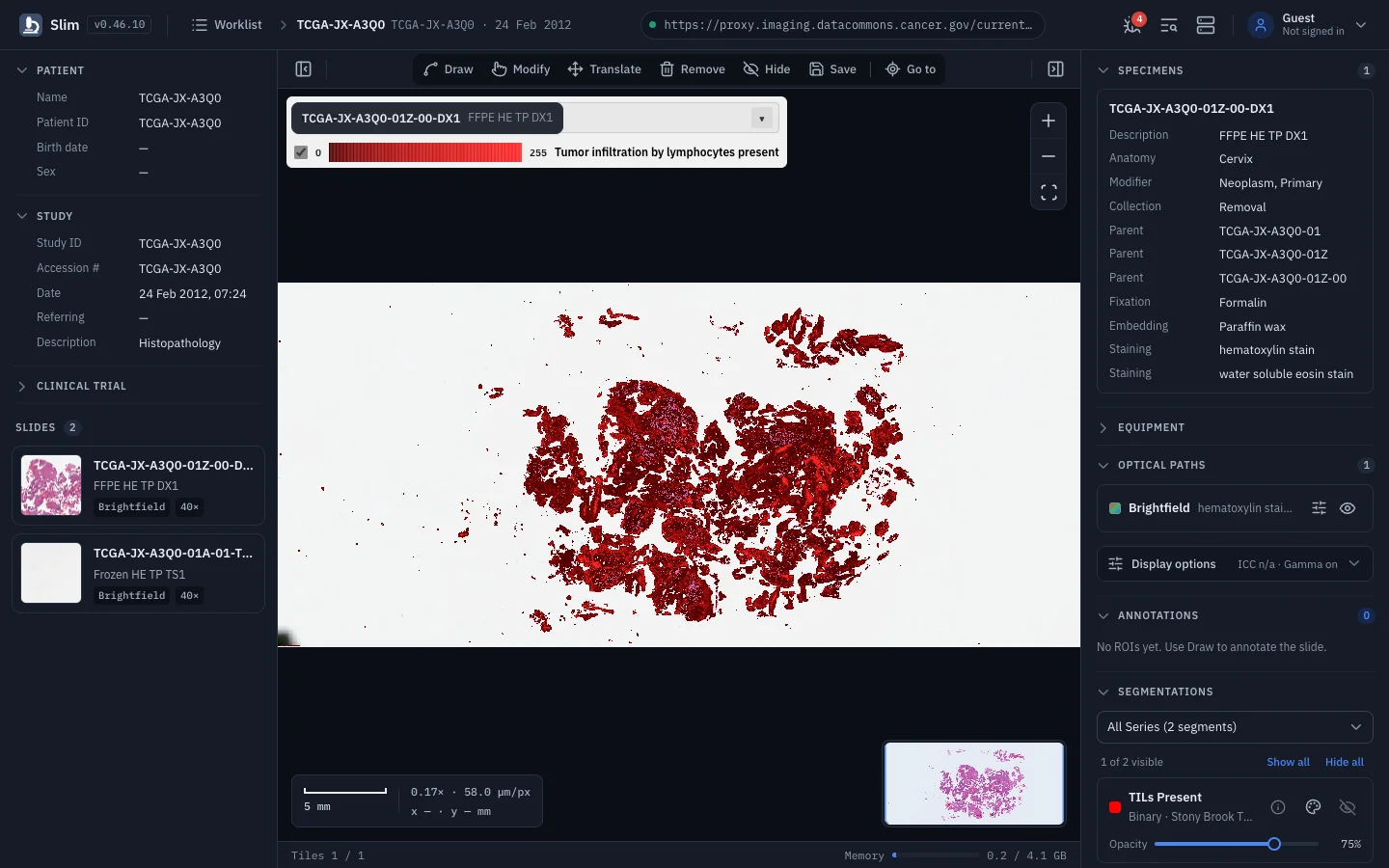 Slim: AI and analysis results as overlays
