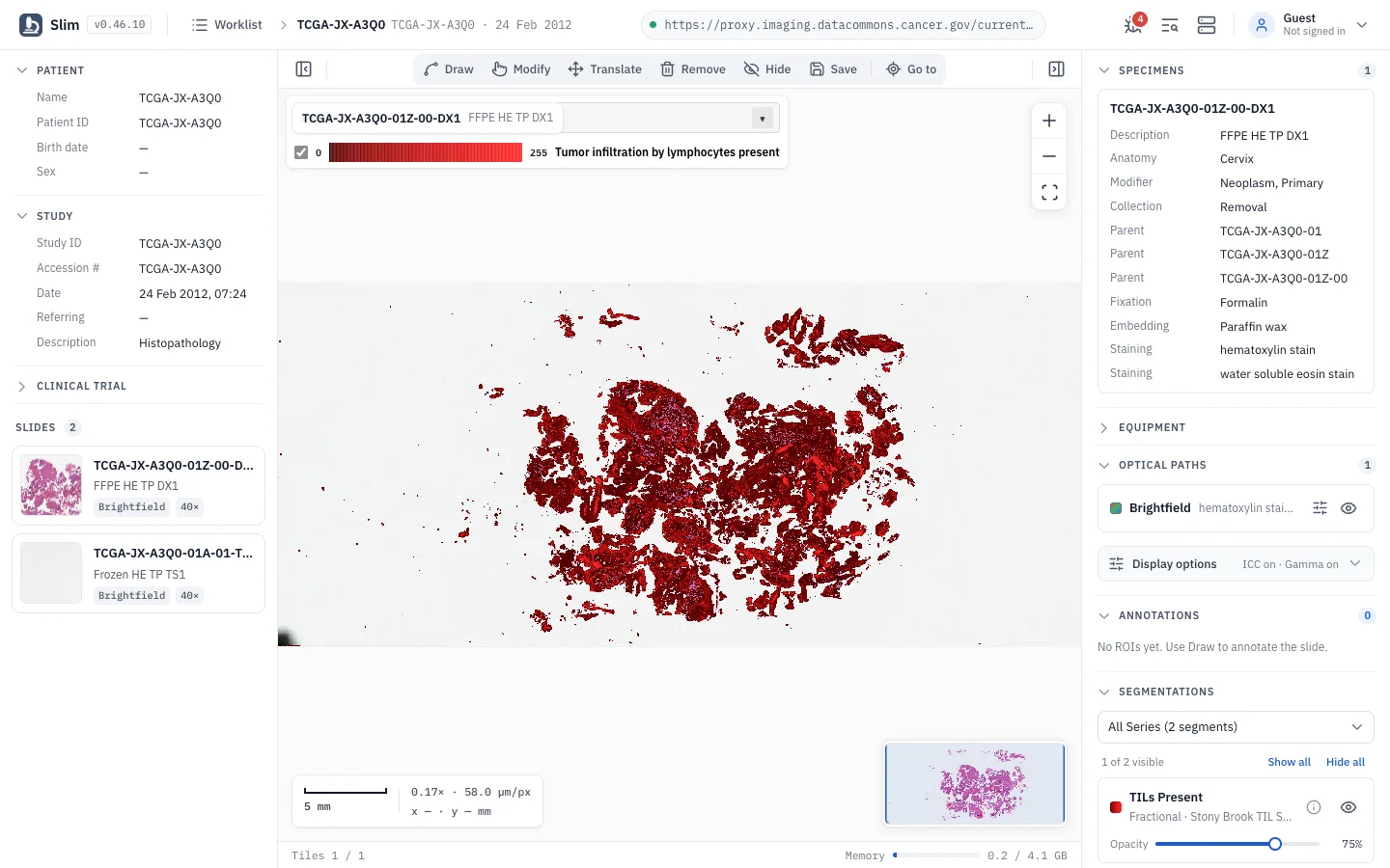 Slim: AI and analysis results as overlays